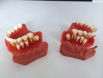Bērnu zobi, lai uzliktu zobu modelis mutvārdu modeļa Lapu zobus un pastāvīgo zobu mainīgs displeja modelis Zoba modelis