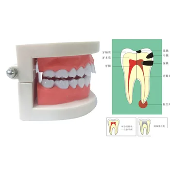 ABS, PVC Zobu Modelis Mutvārdu Instrumentu Instrumenti Zobārstniecības preces Zobu Samazinājuma Modeli, Medicīniskā Aprūpe, Mācību līdzekļiem, Zobu Modelis