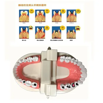 ABS, PVC Zobu Modelis Mutvārdu Instrumentu Instrumenti Zobārstniecības preces Zobu Samazinājuma Modeli, Medicīniskā Aprūpe, Mācību līdzekļiem, Zobu Modelis
